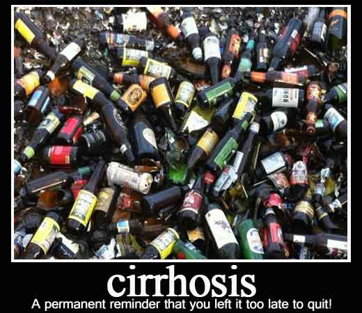 Alcohol and Cirrhosis
