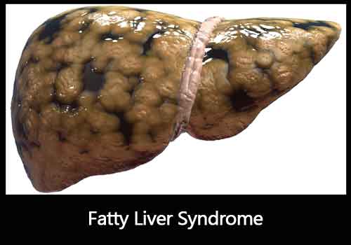Alcohol & Fatty Liver Syndrome