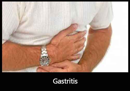 Alcohol & Gastritis