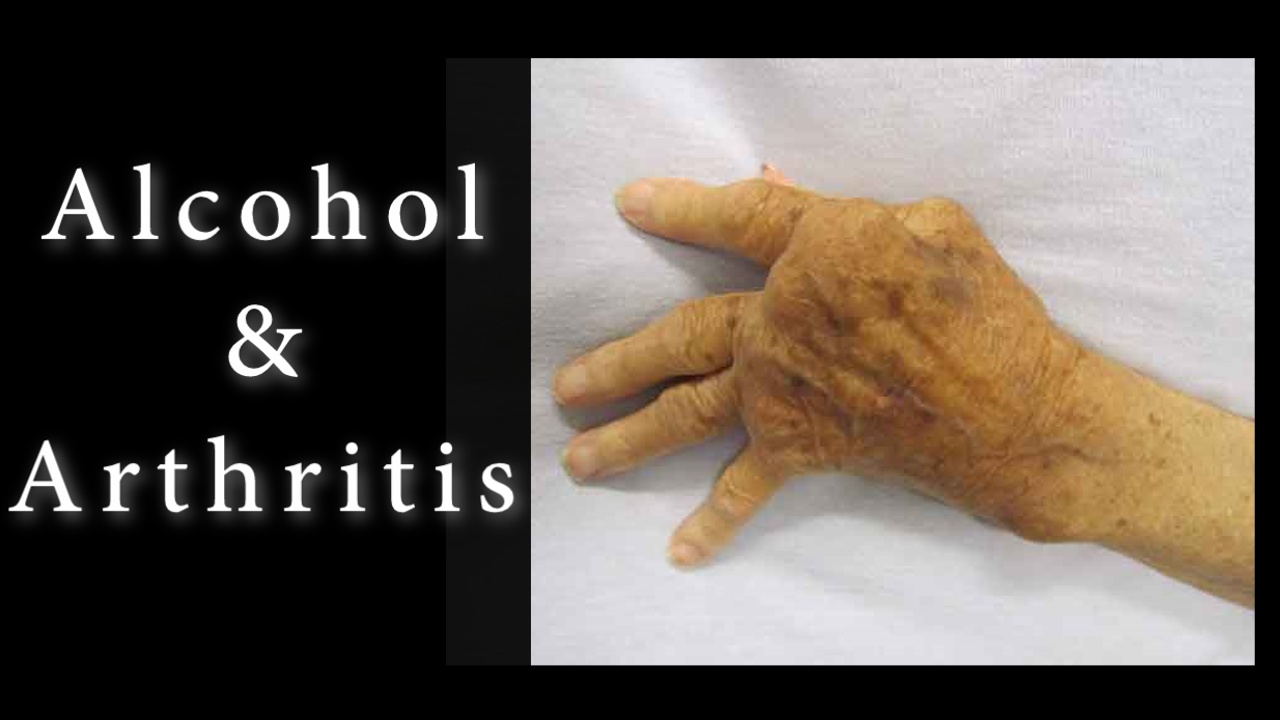 Can You Get Arthritis from Drinking Alcohol? What Can You Do?