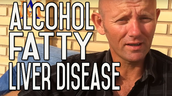 Alcohol and Fatty Liver Disease: Symptoms, Cause, Effect, Outlook